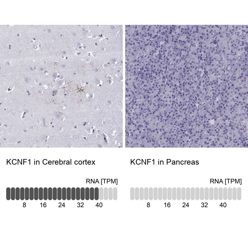 Anti-KCNF1 Antibody