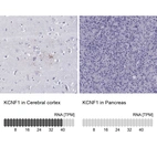 Anti-KCNF1 Antibody