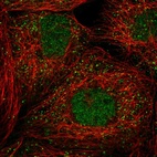 Immunofluorescent staining of human cell line A-431 shows localization to nucleoplasm & vesicles.