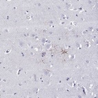 Immunohistochemical staining of human cerebral cortex shows high expression.