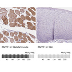 Anti-SMYD1 Antibody