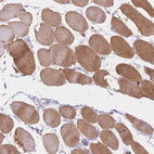 Anti-SMYD1 Antibody