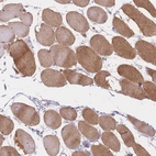Immunohistochemical staining of human skeletal muscle shows moderate cytoplasmic positivity in myocytes.