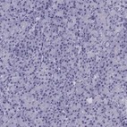 Immunohistochemical staining of human pancreas shows low expression as expected.