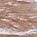 Immunohistochemical staining of human heart muscle shows moderate cytoplasmic positivity in cardiomyocytes.