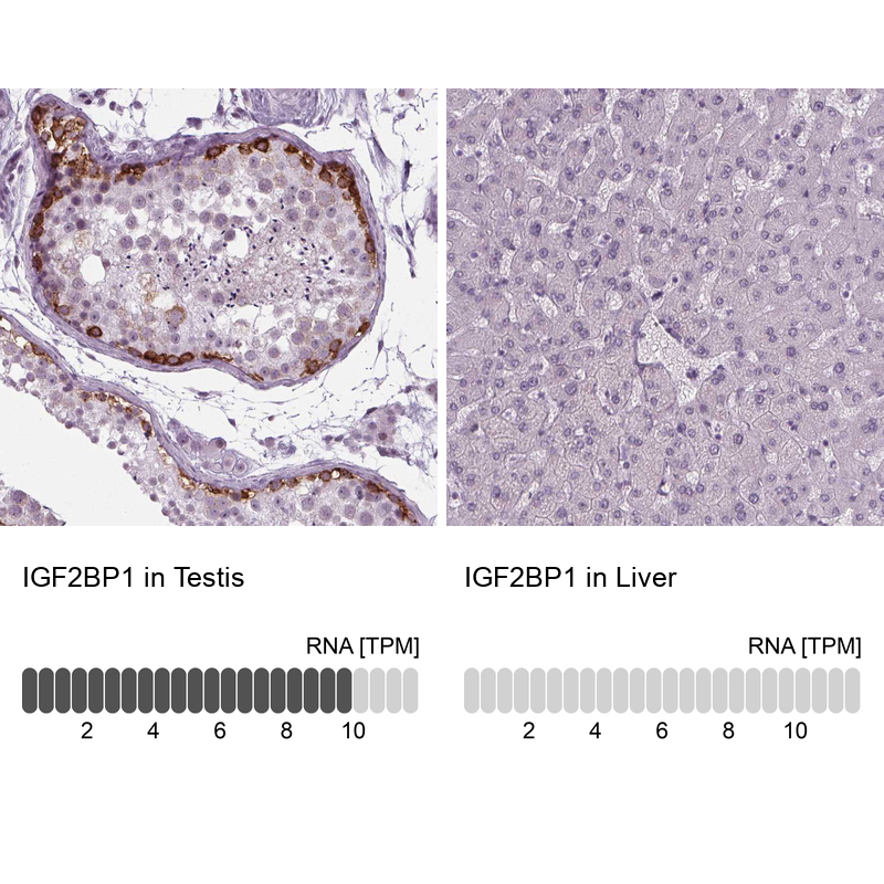 Anti-IGF2BP1 Antibody