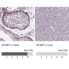 Anti-IGF2BP1 Antibody