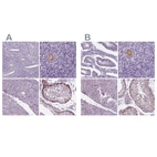 Immunohistochemical staining of human endometrium, ovary, pancreas and testis using Anti-IGF2BP1 antibody HPA062273 (A) shows similar protein distribution across tissues to independent antibody HPA021367 (B).