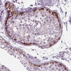 Immunohistochemical staining of human testis shows strong cytoplasmic positivity in cells in seminiferous ducts.