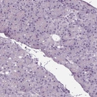 Immunohistochemical staining of human pancreas shows no positivity in exocrine glandular cells as expected.