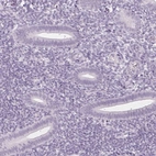 Immunohistochemical staining of human endometrium shows no positivity in glandular cells as expected.