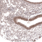 Anti-MSH3 Antibody