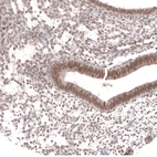 Immunohistochemical staining of human endometrium shows moderate nuclear positivity in glandular and in stromal cells.