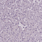 Anti-IGF2BP1 Antibody