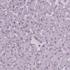 Immunohistochemical staining of human liver shows no positivity in hepatocytes as expected.