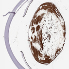 Anti-CRYBA2 Antibody