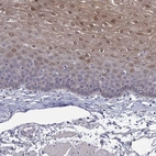 Anti-PADI1 Antibody