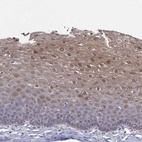 Immunohistochemical staining of human esophagus shows high expression.