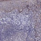 Immunohistochemical staining of human tonsil shows weak cytoplasmic positivity in squamous epithelial cells.