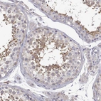 Immunohistochemical staining of human testis shows weak to moderate cytoplasmic positivity in cells in seminiferous ducts.