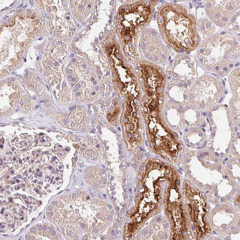 Anti-UNC13B Antibody