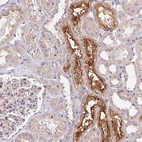 Anti-UNC13B Antibody