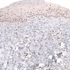 Immunohistochemical staining of human uterine cervix shows moderate nuclear positivity in squamous epithelial cells.