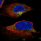 Immunofluorescent staining of human cell line U-2 OS shows localization to the Golgi apparatus & vesicles.