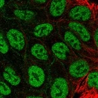 Immunofluorescent staining of human cell line RT4 shows localization to nucleoplasm & cell junctions.