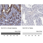 Anti-SLC1A1 Antibody