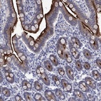 Anti-SLC1A1 Antibody