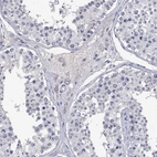 Immunohistochemical staining of human testis shows low expression as expected.