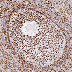 Anti-NUCKS1 Antibody