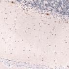 Immunohistochemical staining of human cerebellum shows moderate nuclear positivity in Purkinje cells.