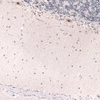 Immunohistochemical staining of human cerebellum shows moderate nuclear positivity in Purkinje cells.