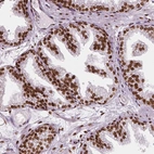 Immunohistochemical staining of human prostate shows strong nuclear positivity in glandular cells.