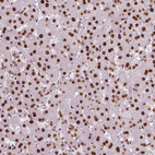 Anti-NUCKS1 Antibody