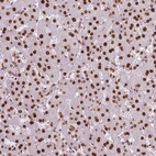 Immunohistochemical staining of human liver shows strong nuclear positivity in hepatocytes.