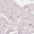 Immunohistochemical staining of human skeletal muscle shows strong nuclear positivity in myocytes.