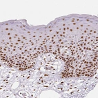 Immunohistochemical staining of human skin shows strong nuclear positivity in squamous epithelial cells.