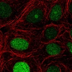 Immunofluorescent staining of human cell line MCF7 shows localization to nucleus & nucleoli.