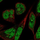 Anti-PANK3 Antibody