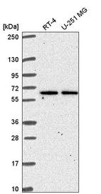 Anti-TMEM62 Antibody