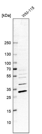 Western blot analysis in human cell line WM-115.