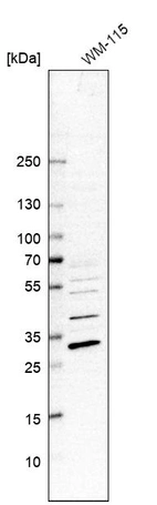 Western blot analysis in human cell line WM-115.