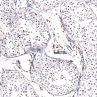 Immunohistochemical staining of human testis shows no positivity in cells in seminiferous ducts.