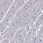 Immunohistochemical staining of human heart muscle shows high expression.