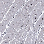 Anti-PSMD2 Antibody