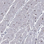Immunohistochemical staining of human heart muscle shows high expression.