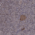 Anti-PSMD2 Antibody